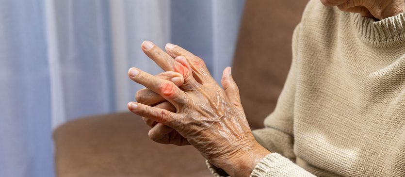 reuma-ancianos-que-es-tratamiento-residencia-el-encinar